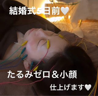 結婚式の5日前に最終メンテナンスで
人生史上最強の小顔に仕上げさせて頂きました


素晴らしい1日のお手伝いができた事とても嬉しいです 