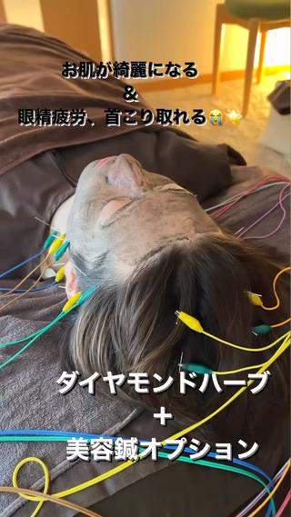 ショート カラー パーマ ヘアアレンジ メンズ キッズ ネイル マツエク・マツパ アイブロウ 即小顔♥️美容鍼× ハーブピーリングのその他イメージ