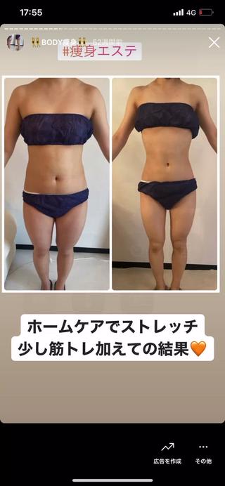 #美容整体
#結果重視 