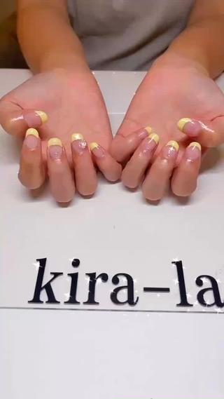 Yellow French × Aurora Shine
ぱっと明るく指先を彩るイエローカラーに、
透明感のあるフレンチデザイン
オーロラストーン＆オーロラローズが
光の角度でキラキラ輝きます
夏にぴったりの爽やか×華やかネイルです
ありがとうございました(>᎑<`๑)♡ 