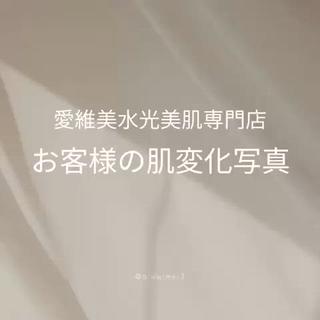 マツエク・マツパ aliaハイフ&水光ジェットサロン所属・aliaハーブ水光店 エステティシャン募集のエステ・リラクイメージ