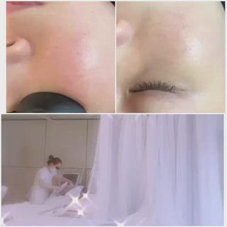 aliaハイフ&水光ジェットサロン所属・aliaハーブ水光店 エステティシャン募集のエステ・リラクイメージ