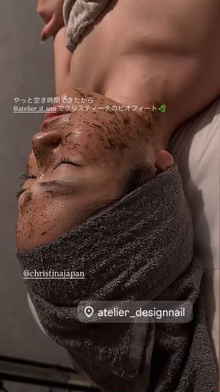 ハーブピーリング 