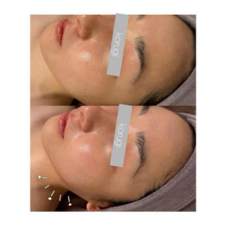 ☆痩身/小顔☆ 結果出します☆のエステ・リラクイメージ