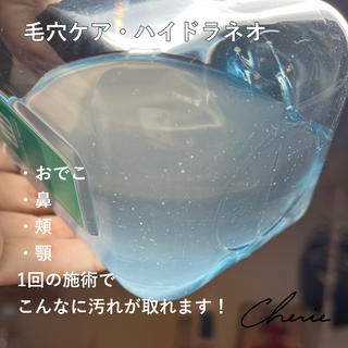 毛穴ケア・ハイドラネオ 