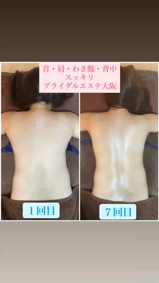 骨格のラインが出て、お肉と浮腫みもスッキリ
お肌の血色も綺麗になりました
頭蓋骨小顔矯正で顔のスッキリもですが、首の傾き歪みもスッキリしました
ブライダルエステ・大切な撮影に向けて・ボディメイクやダイエットをされている方はチェックしてみてください