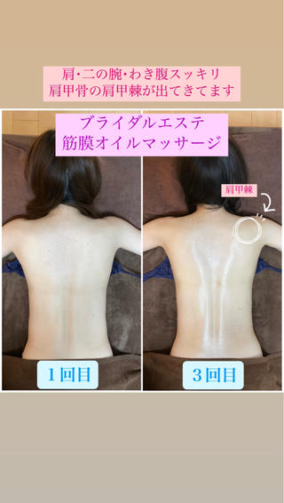 ブライダルエステで骨格姿勢矯正・筋膜オイルマッサージを受けていただきました
施術にもですが、お伝えしたセルフケアも頑張っていただき、さらに綺麗になってきております
結婚式が楽しみですね
しっかりサポートさせていただきます
姿勢矯正・美容整体と痩身エステを同時に受けられるプライベートサロンです
