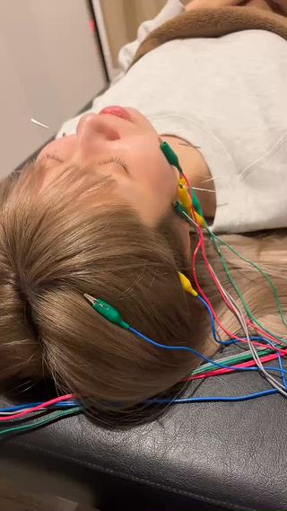 パルスで顔が動いてリフトアップします 