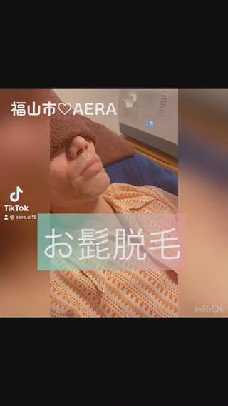 メンズ必見【髭脱毛~全身までスピード脱毛】