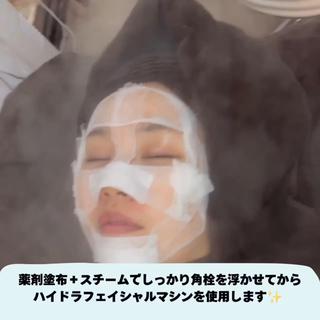 弊店のハイドラフェイシャルは、薬剤塗布＋スチームをしてしっかり角栓を浮かせてからハイドラフェイシャルマシンを使用します 