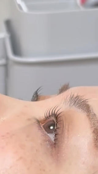 メーテル♡BeforeAfter 