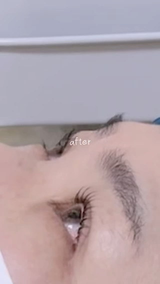 カール♡BeforeAfter 