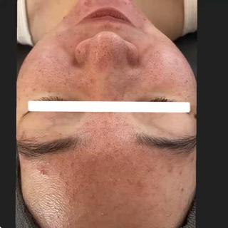 美時雨・bishigure所属・美時雨 bishigureのエステ・リラクイメージ