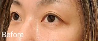 ジェニファーラッシュリフト 