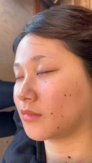 シェービングで産毛をなくしてピカピカお肌透明感も出て日頃のお手入れも楽ちんに 