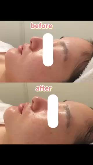 before afterの動画です 