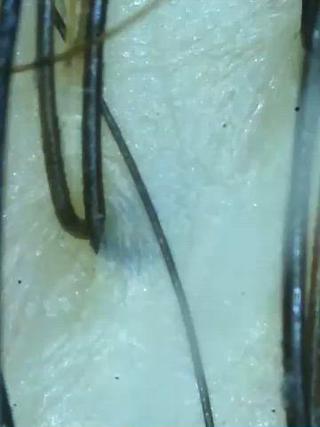 頭皮クレンジング 