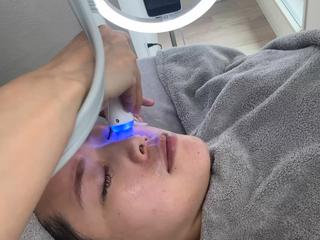 ハイドラ毛穴洗浄 