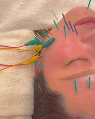 Ayaka🤍 恵比寿/美容鍼/整体のエステ・リラクイメージ