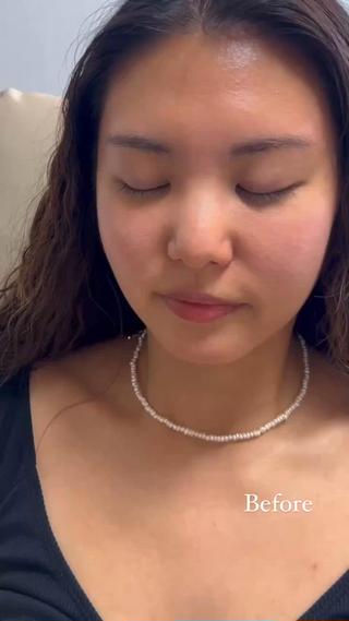 ハリウッドブロウリフトフェイシャルWax
HBLで眉毛を整えた後
フェイシャルWaxで艶肌にさせて頂きました
(お肌はノーメイクです︎)
ワックス後はパックなどスペシャルケアをして頂くと
より効果を発揮してくれるので是非してみて下さい