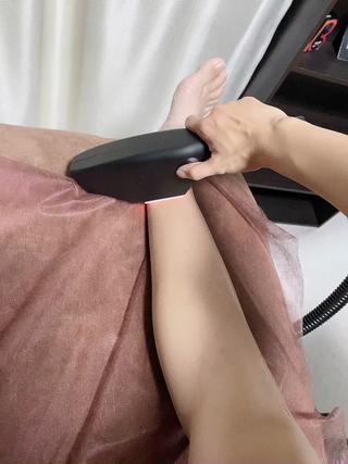 ハイブリッド脱毛 