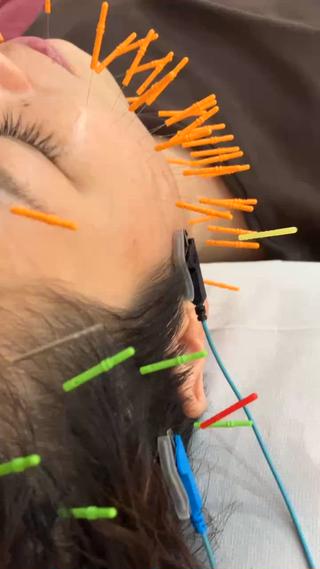 美容鍼灸女性専用 りんご鍼灸治療院のエステ・リラクイメージ