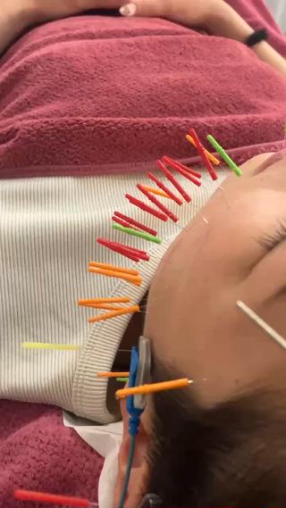 美容鍼灸女性専用 りんご鍼灸治療院のエステ・リラクイメージ