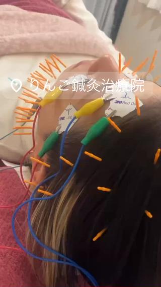 美容鍼灸女性専用 りんご鍼灸治療院のその他イメージ