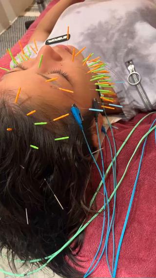 美容鍼灸女性専用 りんご鍼灸治療院のエステ・リラクイメージ