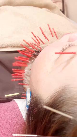 美容鍼灸女性専用 りんご鍼灸治療院のエステ・リラクイメージ