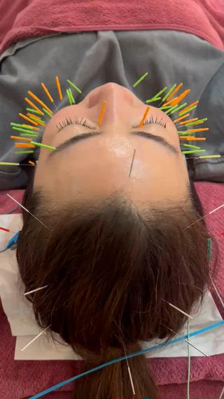 美容鍼灸女性専用 りんご鍼灸治療院のエステ・リラクイメージ