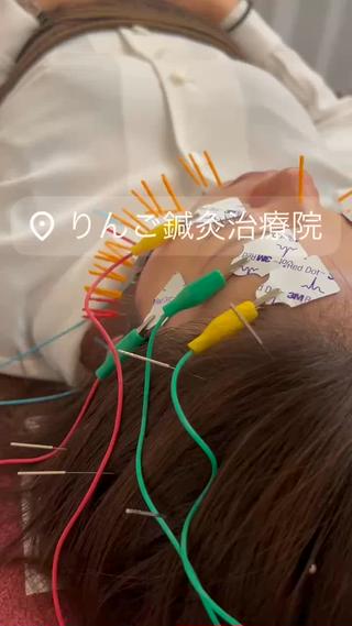 美容鍼灸女性専用 りんご鍼灸治療院のその他イメージ