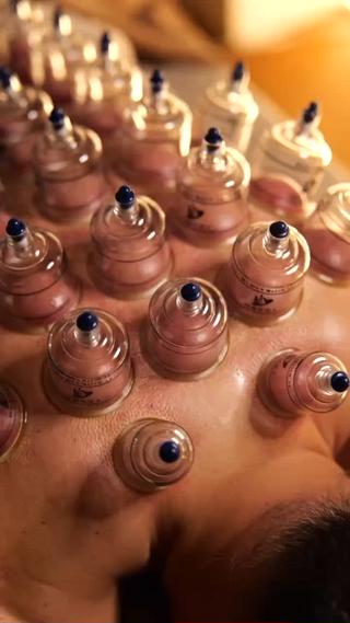 カッピングで血流促進!