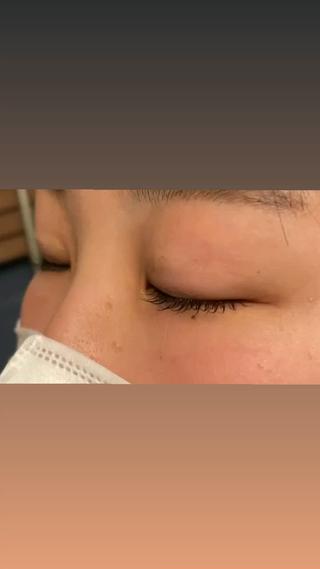 他店に行った際に上がりにくいとカウンセリングでお聞きしてしっかり上がるようにご対応させて頂きましたしっかり上がって安心いたしました
ありがとうございました

初回カウンセリングは特に丁寧にさせて頂きますので、お気軽にまつ毛のご相談ください
 