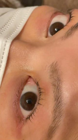 パッチリ素敵なお目元になりましたありがとうございました 