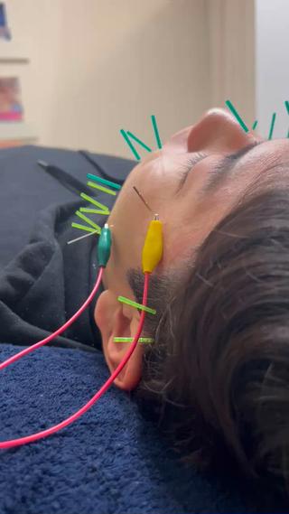 美容鍼×小顔×姿勢× ブライダル整体のエステ・リラクイメージ