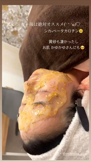 シュガーリング×ハイドロジェリーマスク 