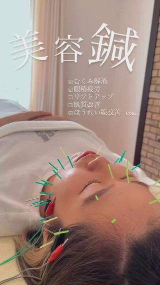 大人気メニュー美容鍼 