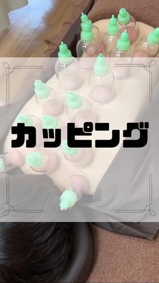 カッピング施術風景

皮膚に吸いついておもしろいですね
血流が悪かったり、痛みのある部分は
特に色が濃くつきます！
 