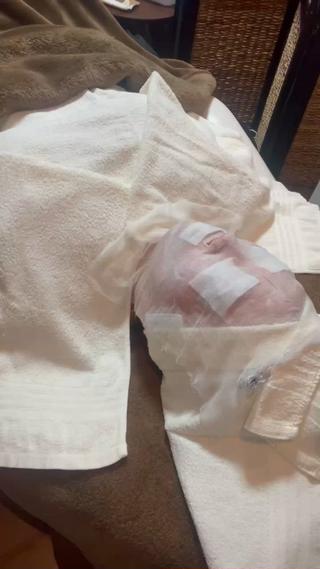 パ〜ル石膏パックはお顔に塗布し少しずつ固まりポカポカとても気持ち良く最高でも40℃前後まで温度が上がります。石膏パックでお肌を密封する事により美容成分を発熱効果と冷却効果の相乗効果によって美肌へと導きます。優れた即効性の高い極上のトリ〜トメントパックです
[石膏パックの効果]
・リフトUP↑↑↑
・毛穴の引き締め
・エイジングケア
・乾燥ジワ 乾燥肌
・くすみ
・美白
・もちもち肌
・潤い
・
ご注意
＊鼻詰まり ＊傷 ケガ
＊閉所恐怖症 ＊暗所恐怖症
により施術をお受け出来ない場合がございます。
お気軽にご相談下さいませ〜
＊お肌に塗っても問題のない成分が使用されています。 