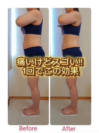 筋膜リリース1回の効果です!!

筋肉を剥がしたり伸ばしたりすることで、筋肉を正しい位置の戻し、スタイルアップわ代謝を上げていく施術です。

初回、筋膜の癒着がある部分は痛みを感じるところがあるかと思います。
施術後はカラダの軽さが実感できます。
癒着がひどかったところから筋肉痛のような感覚がある方もいらっしゃいますが、２日後あたりからカラダの調子が良くなり持続性があると言われます。

筋膜リリースは1週間～10日に1回
6回コースを２～3クールがオススメです。
その後は、目的に合わせてご案内させていただきます
 