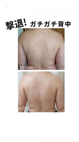 筋膜リリース6回コース×３セット

週1～10日の1回のペースでご来店いただきました。 