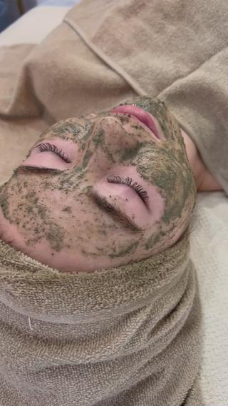 ダウンタイムのないハーブピーリングでつやん 