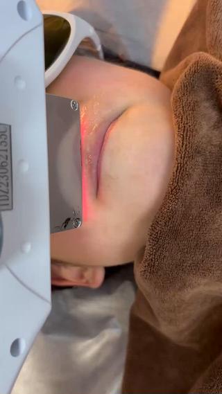 顔脱毛メークで隠そうとすればするほど目立ちます！
お肌の色は明るくメークのりも完ぺき 