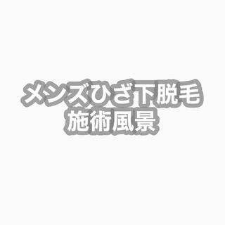 脱毛の施術風景です