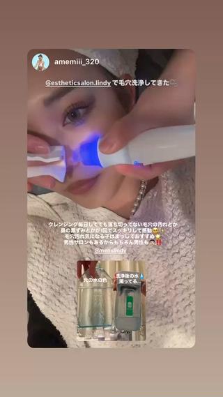 大人気のハイドラ毛穴洗浄が格安で受けれます。
アメミちゃんもお気に入り
毛穴の黒ずみ解消だけでなくスクライパーでお肌ツルツルに

美容液導入も出来ます♪

こちらは男女施術可能です。 