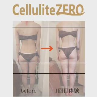 セルライトZEROの最新マシーンで代謝アップ、ダイエット効果抜群
ボディーラインがみるみる整う 