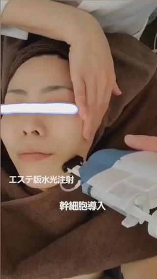 #高濃度ヒト幹細胞 