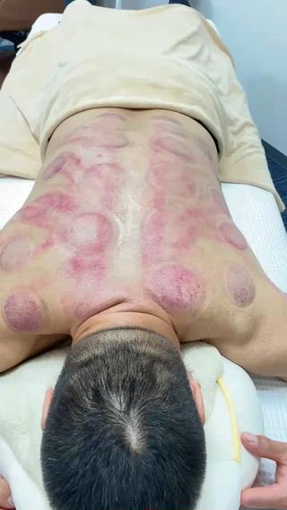 もみほぐしアロマオイルリンパマッサージカッピング 