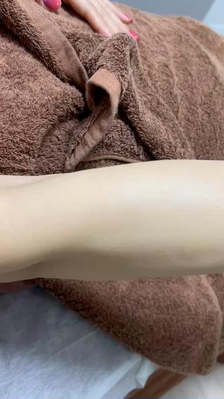 こちらのお客様はもう一年剃ってなくてこの状態です、毛穴の中の黒いぶつぶつも全くありません 